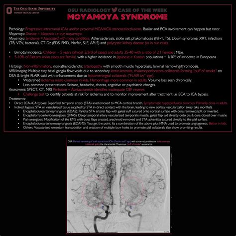 MoyaMoya Syndrome.