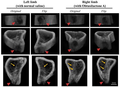 Enhancement of Bone Marrow-Derived Mesenchymal Stem Cell Osteogenesis ...