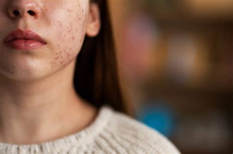 Skin & Nail Infection Treatment in Vapi | STD & Fungal Care