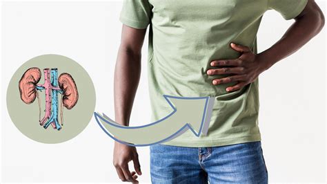 Kidney Cysts: Know Causes, Symptoms, Treatment & Prevention - Boldsky.com