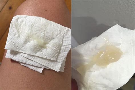 Losing your mucus plug: what happens and what does it look like ...