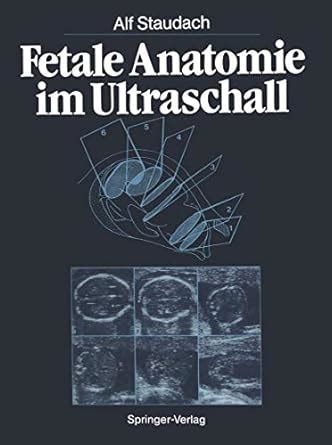Buy Fetale Anatomie im Ultraschall Book Online at Low Prices in India ...
