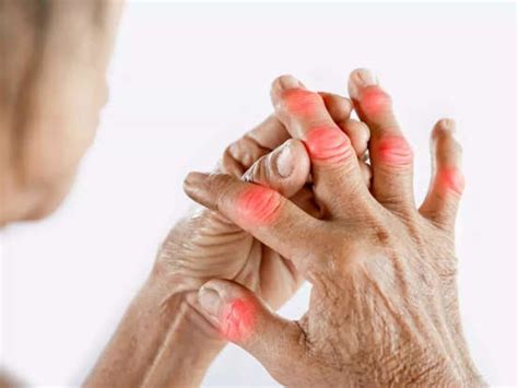 6 signs of high uric acid in the body to watch out for