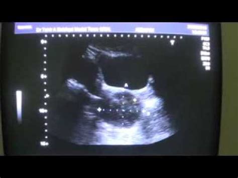 Image result for Alien Xenomorph Cf20