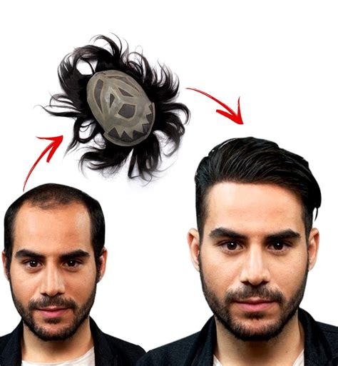 Empire Hair Fixing Studio – Best Hair Patch & Hair Replacement in Jaipur