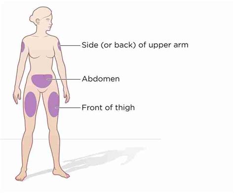 Image result for SubQ Injection Technique