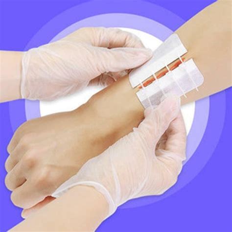 Buy Bandage Band Aid Zip Stitches Zip Tie Wound Closure Adhesive New ...