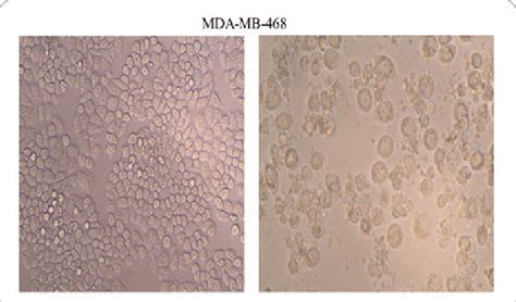 Tumor growth. The growth of MDA-MB-231 and MDA-MB-468 xenograft tumors ...