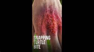 Image result for Man Getting Bit by Snapping Turtle