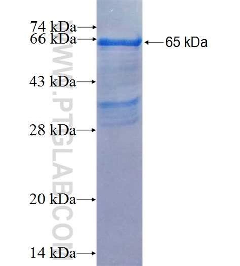 GRIN1 Fusion Protein Ag4754 | Proteintech