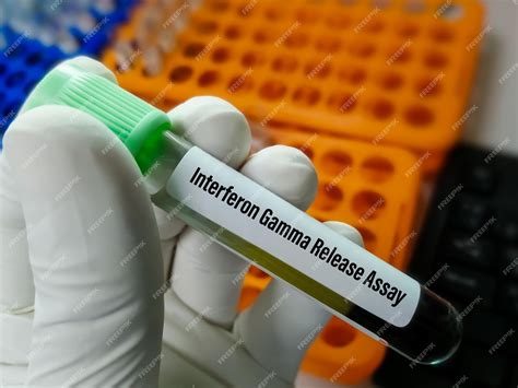 Premium Photo | Blood sample for interferon gamma release assay (igra ...
