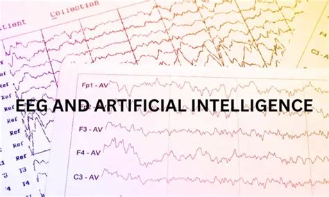 SCORE-AI achieved diagnostic accuracy similar to human experts in EEG ...