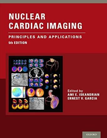Nuclear Cardiac Imaging: Principles and Applications eBook : Iskandrian ...