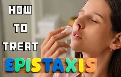 how to treat epistaxis – Dhanwantri Pharmaceuticals India Pvt. Ltd.