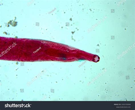 Necator Americanus Labeled