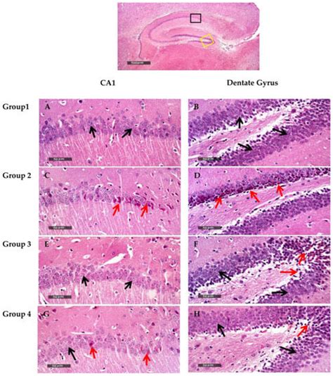 Neuroprotective Effect of Artichoke-Based Nanoformulation in Sporadic ...