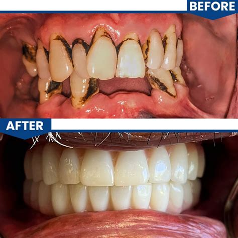 Central Valley Dentistry | Best Family Dentistry in Phoenix, AZ