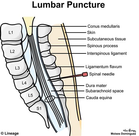 Lumbar Puncture Position