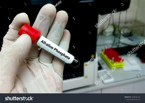 Blood Sample Tube Alp Alkaline Phosphatase Stock Photo 1903934164 | Shutterstock