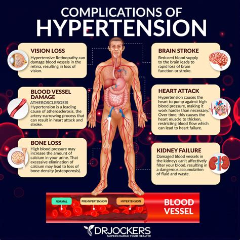 7 Warning Signs You are Eating Too Many Carbs - DrJockers.com