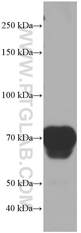 Hemopexin antibody (66479-1-Ig) | Proteintech