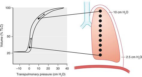 Respiratory Physiology and Pathophysiology - Clinical Tree