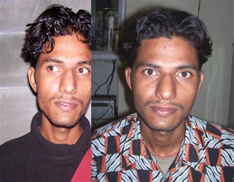 Five Wheeled Car - National Innovation Foundation-India