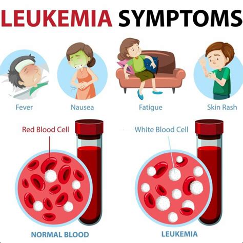 Childhood Leukemia: Symptoms, Treatment, and Support