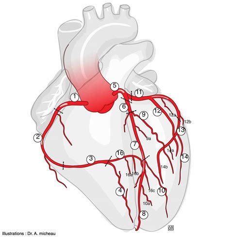 Nazewnictwo tętnic wieńcowych - e-Anatomy - IMAIOS
