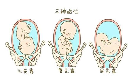 胎儿在子宫中到底有多少姿势？ - 知乎