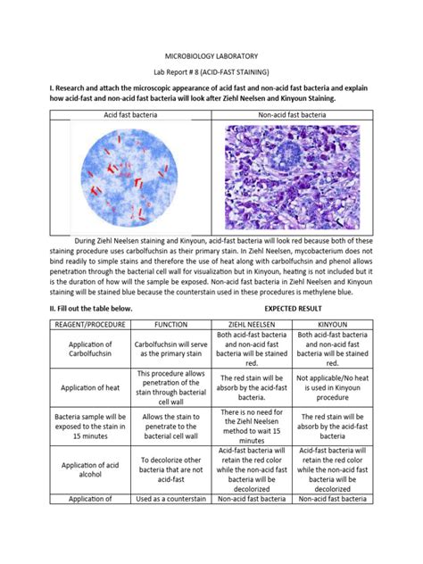 Image result for Acid-Fast Staining Method