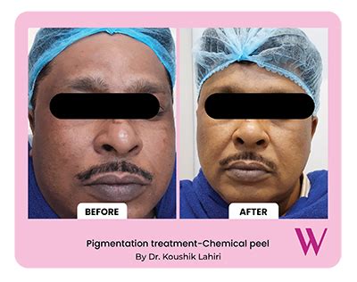 Wizderm Skin and Hair Clinic | Best Dermatologists in India