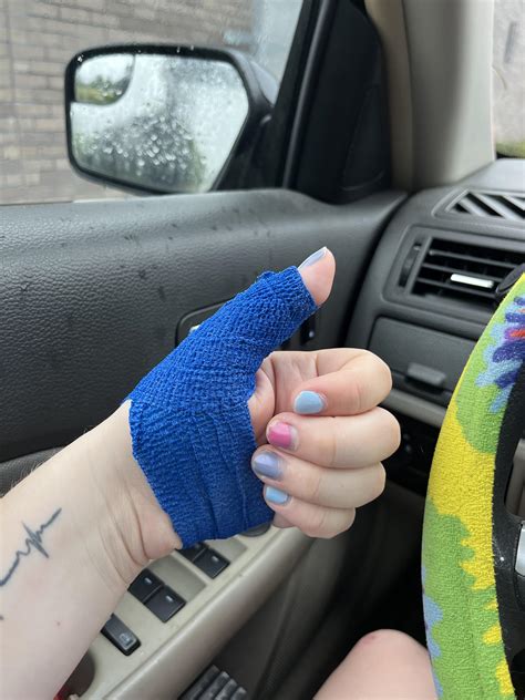 Jammed thumb care? : r/jiujitsu