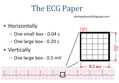 MedicTests.com - Simple explanation of the ECG graph paper! | Facebook