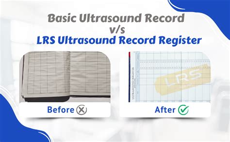LRS Ultrasound Record Register (PNDT Record) - 80 GSM Thick Paper - 100 ...
