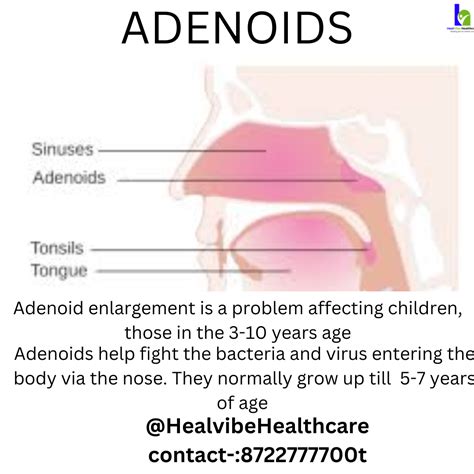 Can Your Adenoids Grow Back In Adults at Gregory Lawerence blog