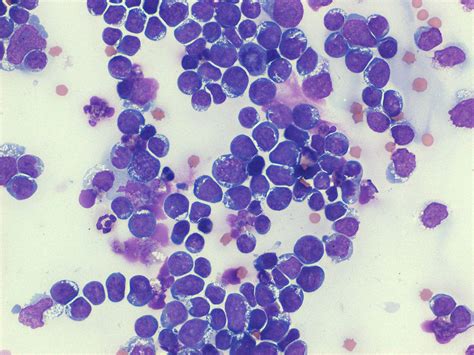 What Is A Cytopathology Test at Alannah Bladen blog