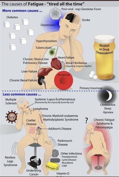 Nephritic vs nephrotic syndrome – Artofit