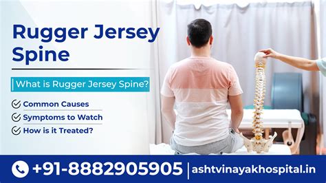 Rugger Jersey Spine: Causes, Symptoms, Diagnosis & Treatment