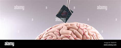 Image result for Brain Computer Interface Chip