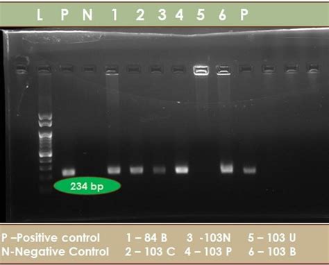 Sample showing RT-PCR positive results | Download Scientific Diagram