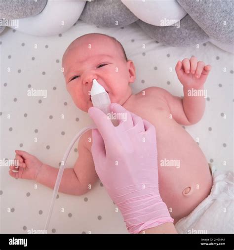 The doctor removes a runny nose with a suction device in a newborn baby ...