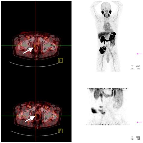 Biomedicines | Special Issue : State of the Art and Future Perspectives ...