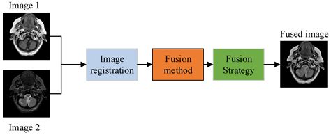CT and MRI Medical Image Fusion Using Noise-Removal and Contrast ...