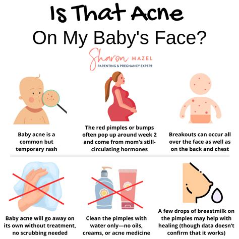 Baby Acne Selfcare