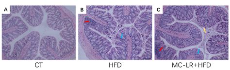 Subchronic Microcystin-LR Aggravates Colorectal Inflammatory Response ...