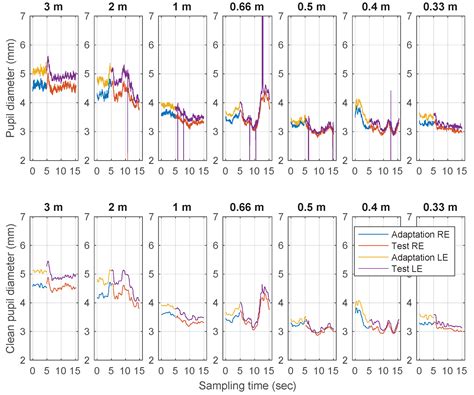 Pupil Function in Pseudophakia: Proximal Miosis Behavior and Optical ...