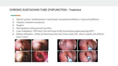 Eustachian tube and it's disorders, ENT | PPTX