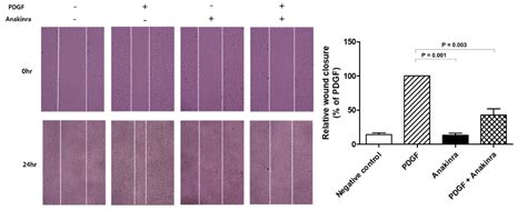 The Anti-Atherosclerosis Effect of Anakinra, a Recombinant Human ...