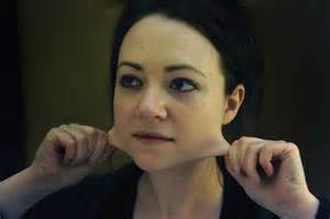 Ehlers-Danlos: the disorder that impacts daily life